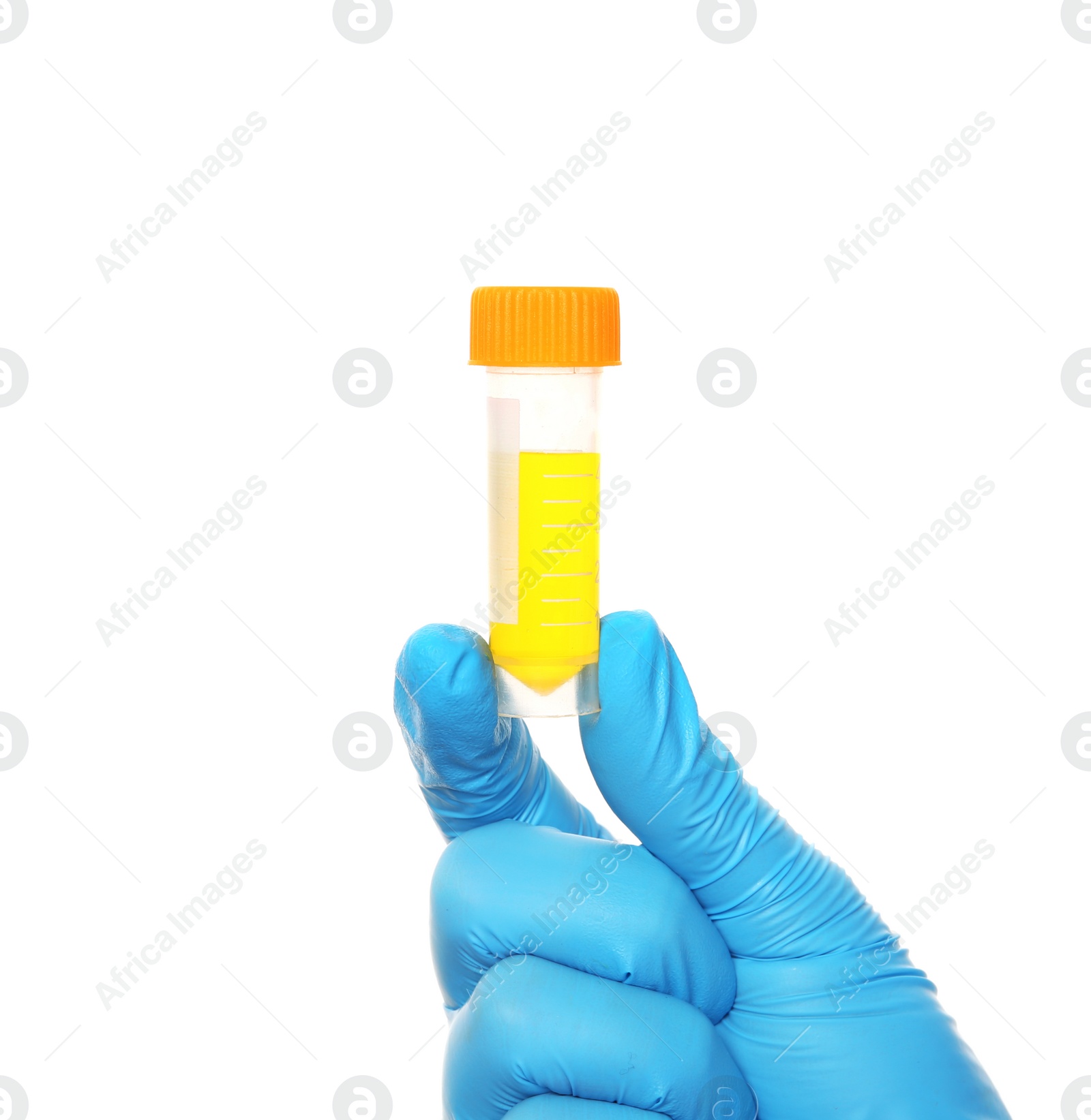 Photo of Laboratory assistant holding container with urine sample for analysis on white background, closeup