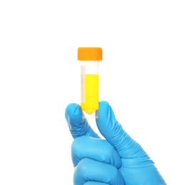 Laboratory assistant holding container with urine sample for analysis on white background, closeup