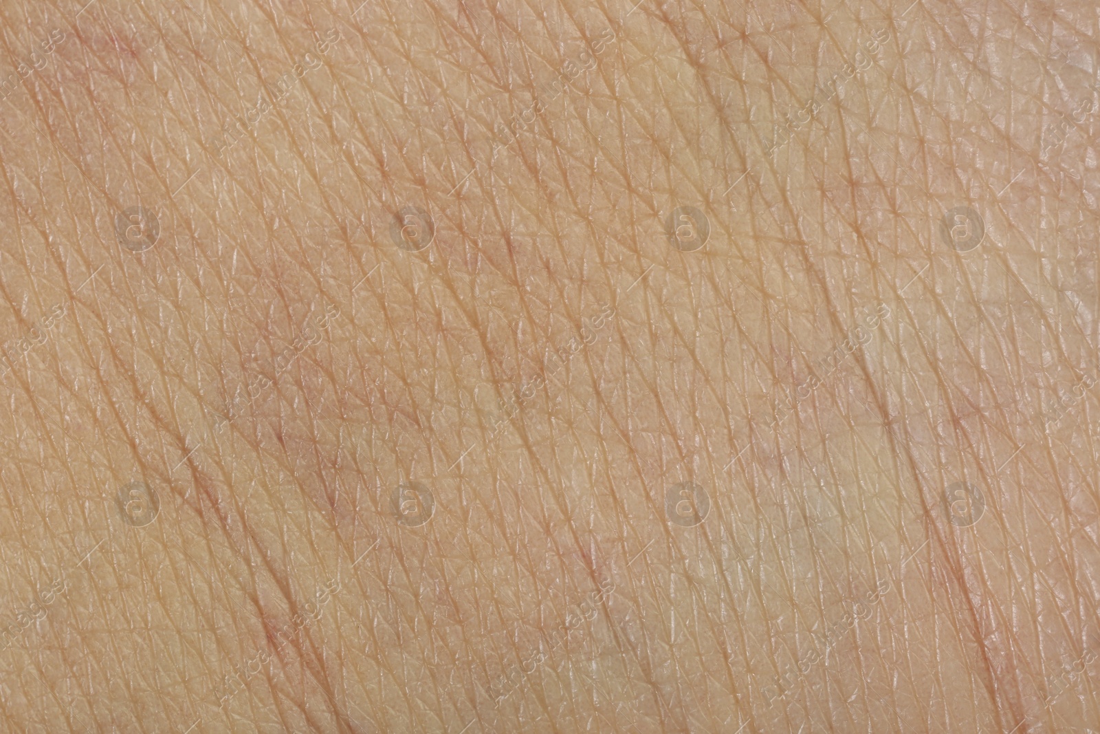 Photo of Texture of healthy skin as background, macro view