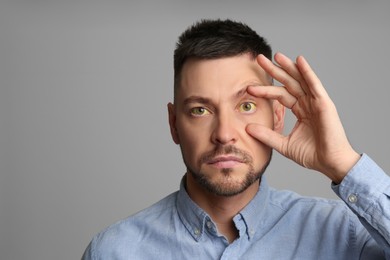 Photo of Man checking his health condition on grey background, space for text. Yellow eyes as symptom of problems with liver