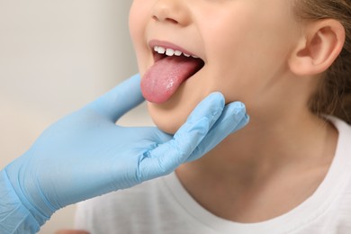 Photo of Doctor examining girl`s oral cavity on light grey background, closeup