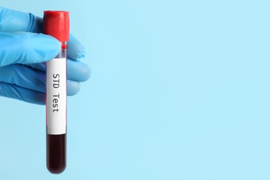 Scientist holding tube with blood sample and label STD Test on light blue background, closeup. Space for text