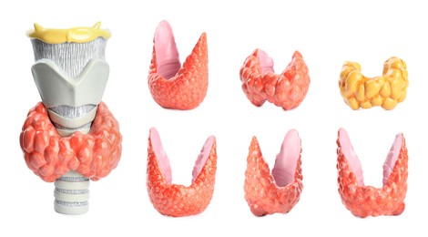 Image of Plastic models of healthy and afflicted thyroid on white background, collage