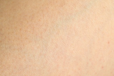 Photo of Texture of clean human skin, closeup view