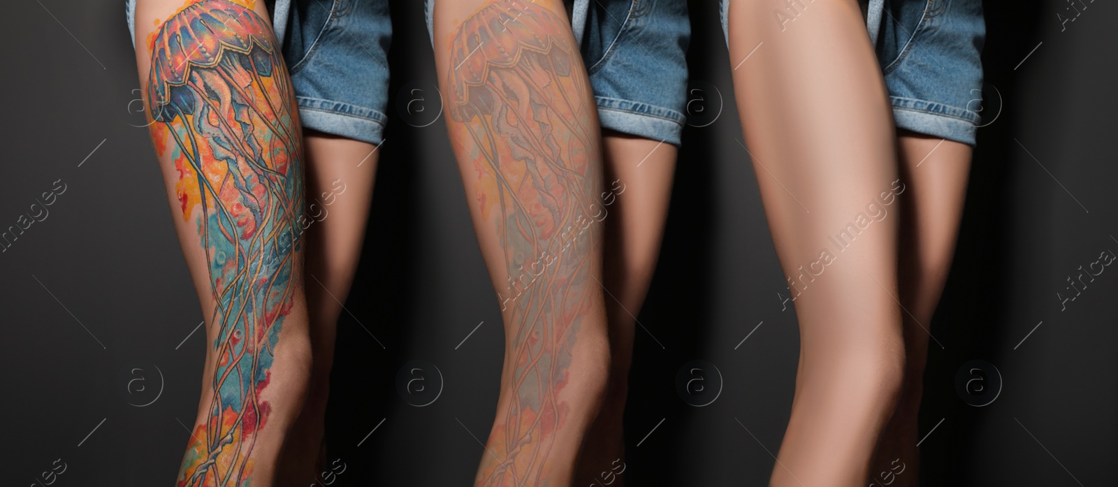 Image of Woman before and after laser tattoo removal procedures on black background, closeup. Collage with photos, banner design