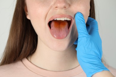 Photo of Gastroenterologist examining patient with yellow tongue on light grey background, closeup