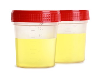 Containers with urine samples for analysis on white background
