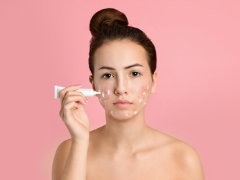 Photo of Teen girl with acne problem applying cream on light pink background