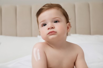 Photo of Cute little baby with cream on arm
