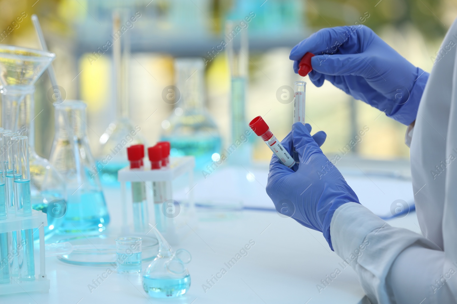 Photo of Scientist working with samples in laboratory, closeup. Medical research