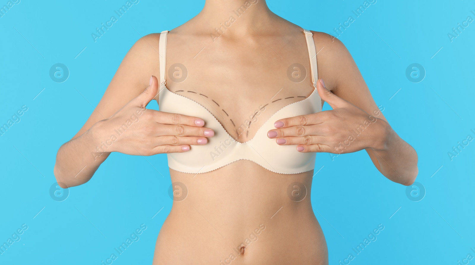 Photo of Young woman with marks on breast for cosmetic surgery operation against color background, closeup