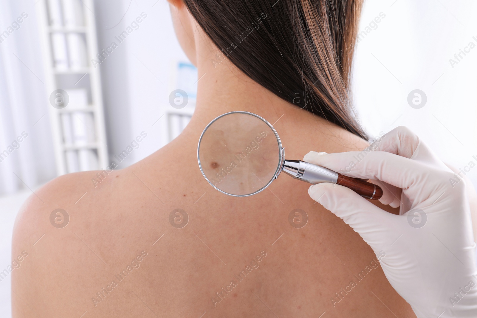 Photo of Dermatologist examining patient with magnifying glass in clinic, closeup view