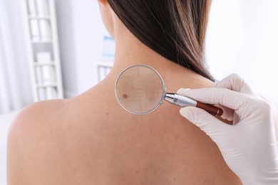 Dermatologist examining patient with magnifying glass in clinic, closeup view