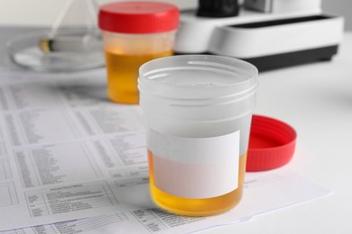 Container with urine sample for analysis on white table, closeup
