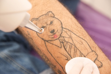 Young man undergoing laser tattoo removal procedure in salon, closeup