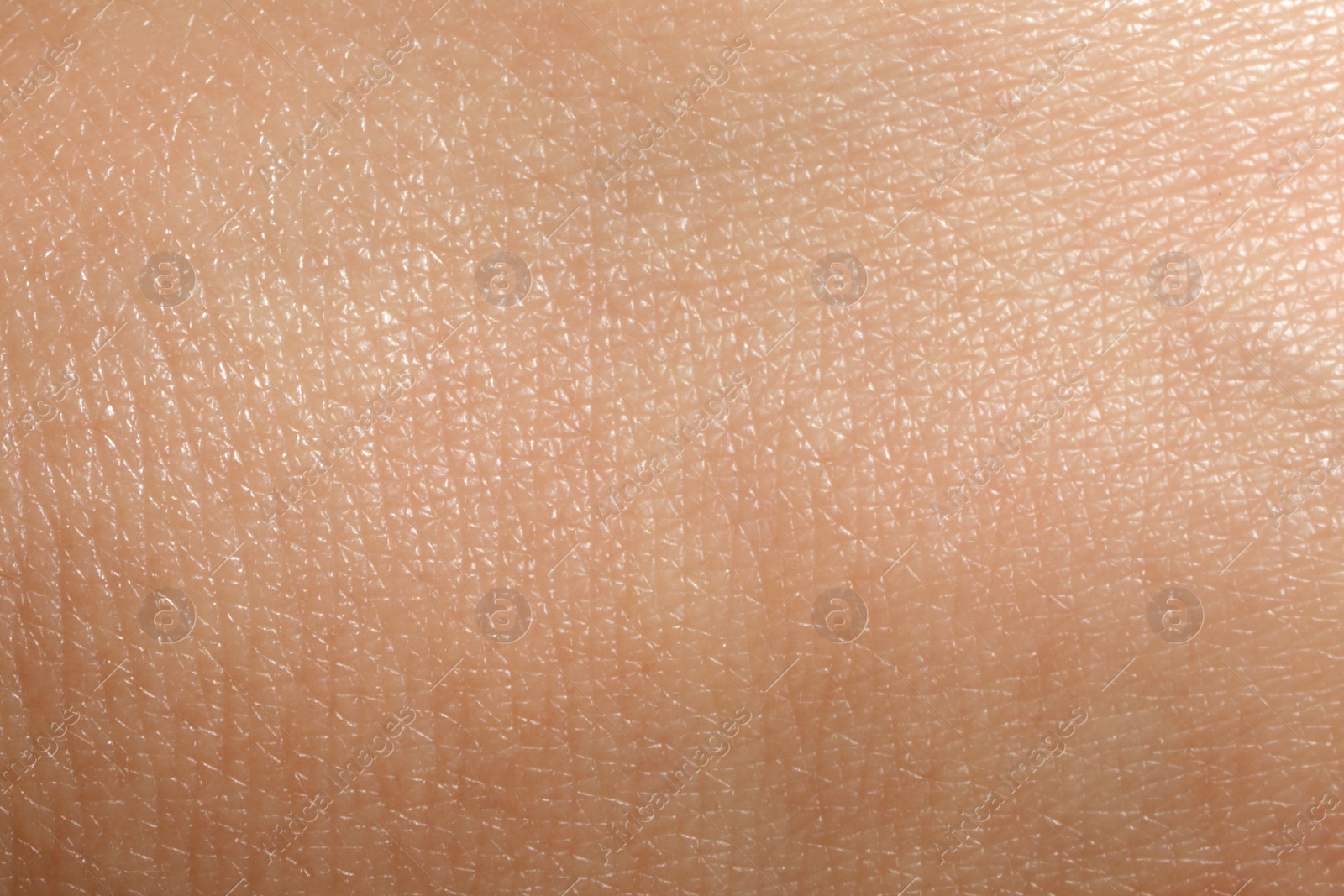 Photo of Closeup view of dry human skin as background