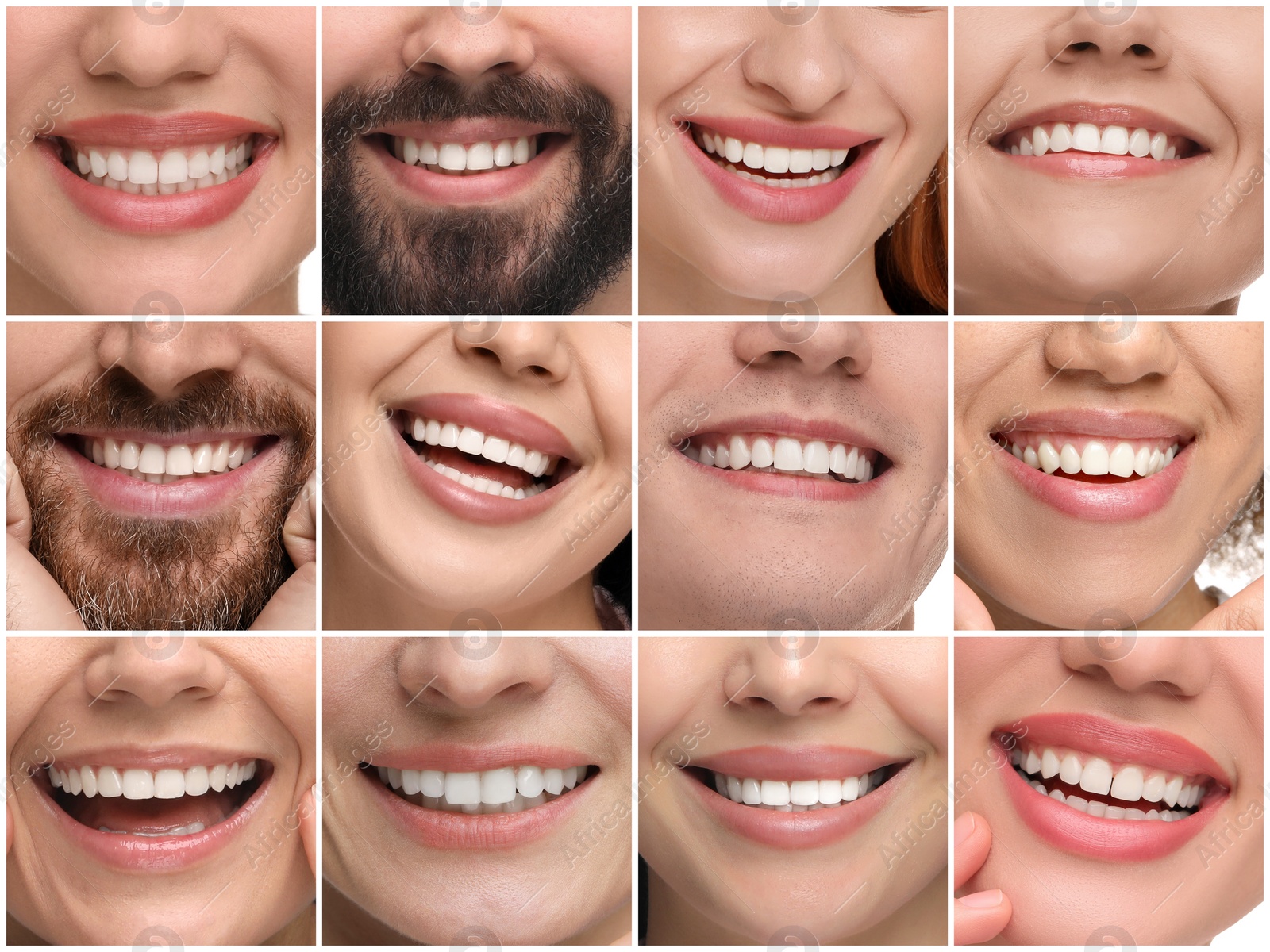 Image of People showing white teeth, closeup. Collage of photos