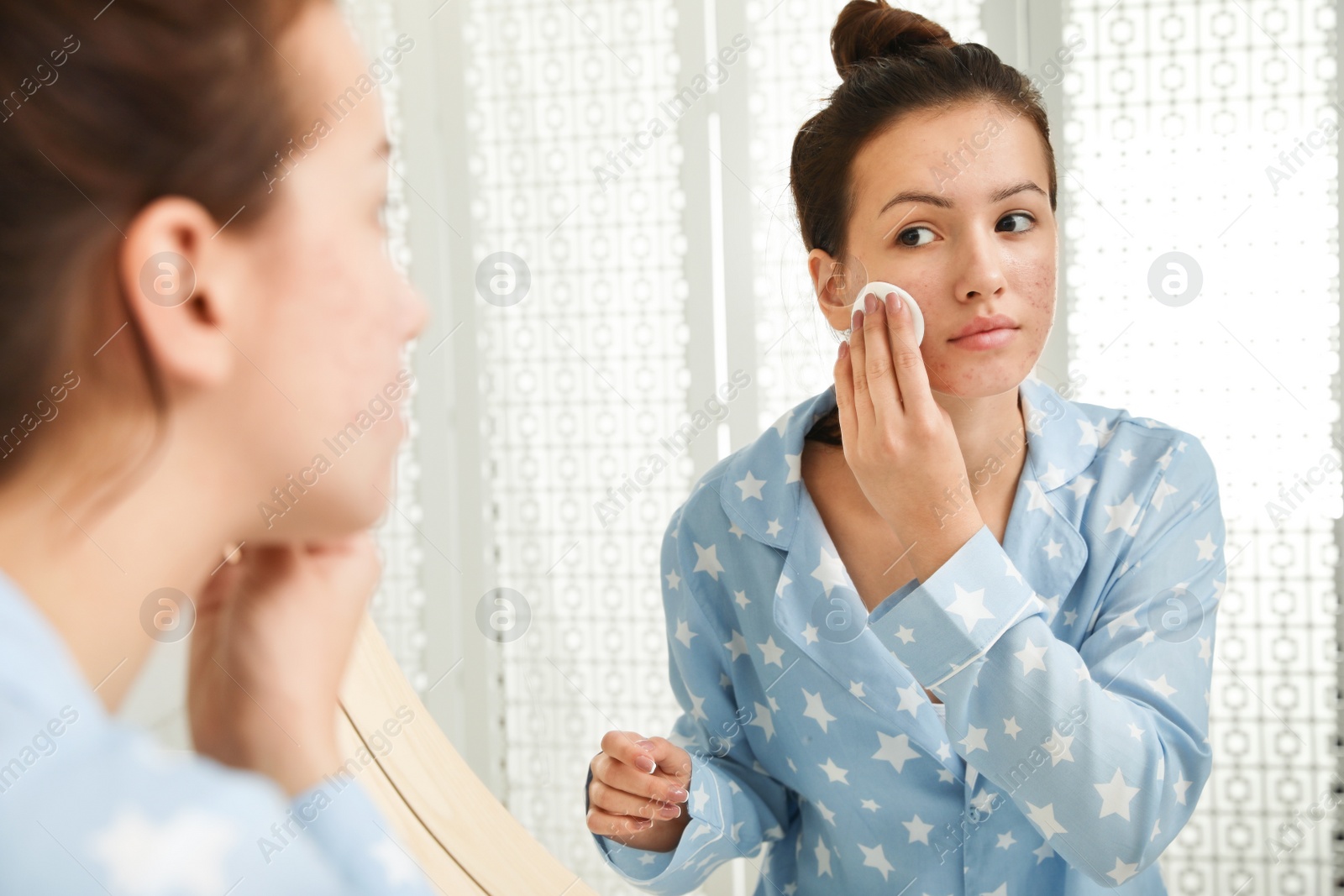 Photo of Teen girl with acne problem cleaning her face near mirror in bathroom