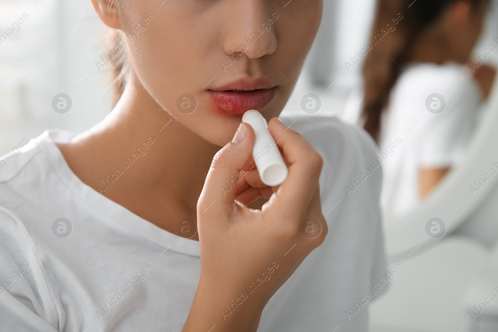 Photo of Woman with herpes applying lip balm against blurred background, closeup