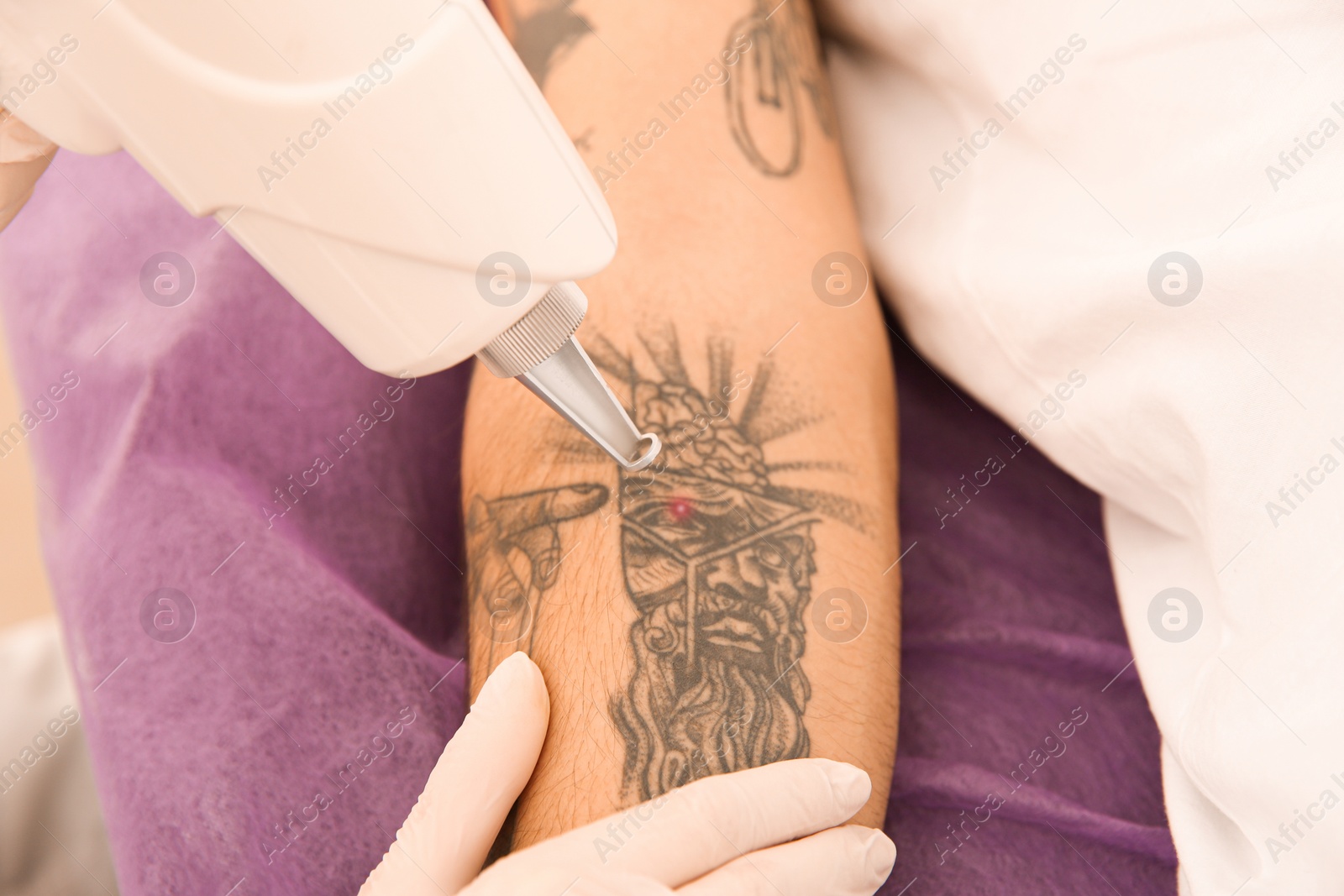 Photo of Young man undergoing laser tattoo removal procedure in salon, closeup