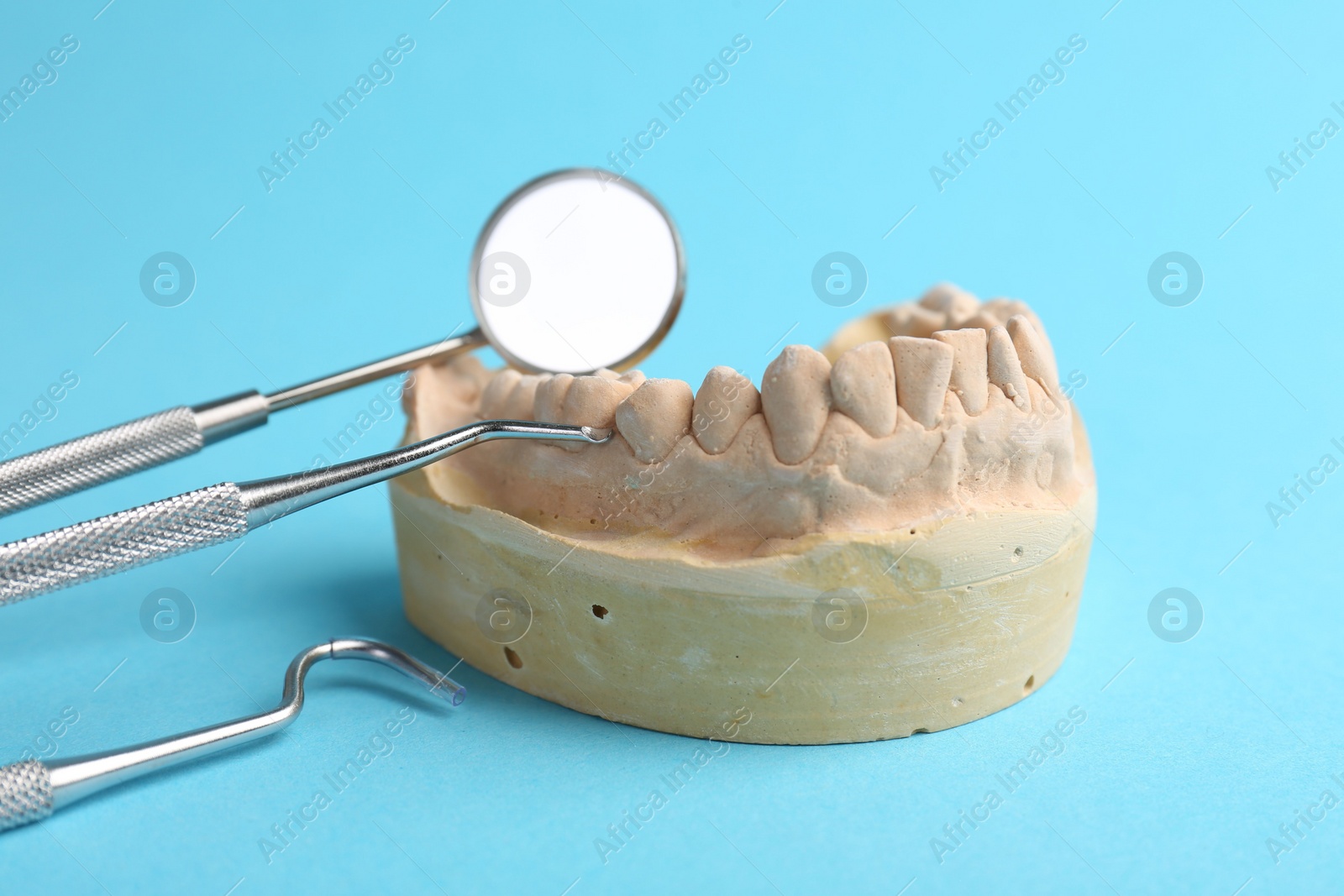 Photo of Dental model with gums and dentist tools on light blue background. Cast of teeth