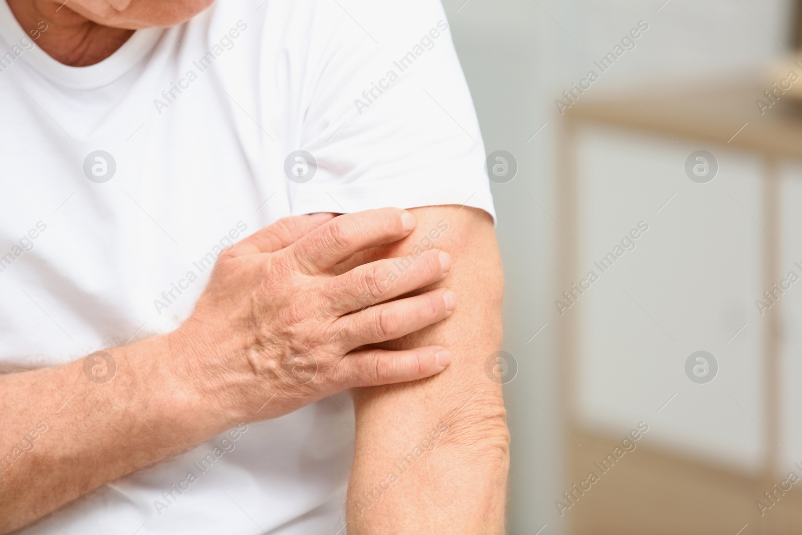 Photo of Senior man scratching arm indoors, closeup with space for text. Allergy symptom