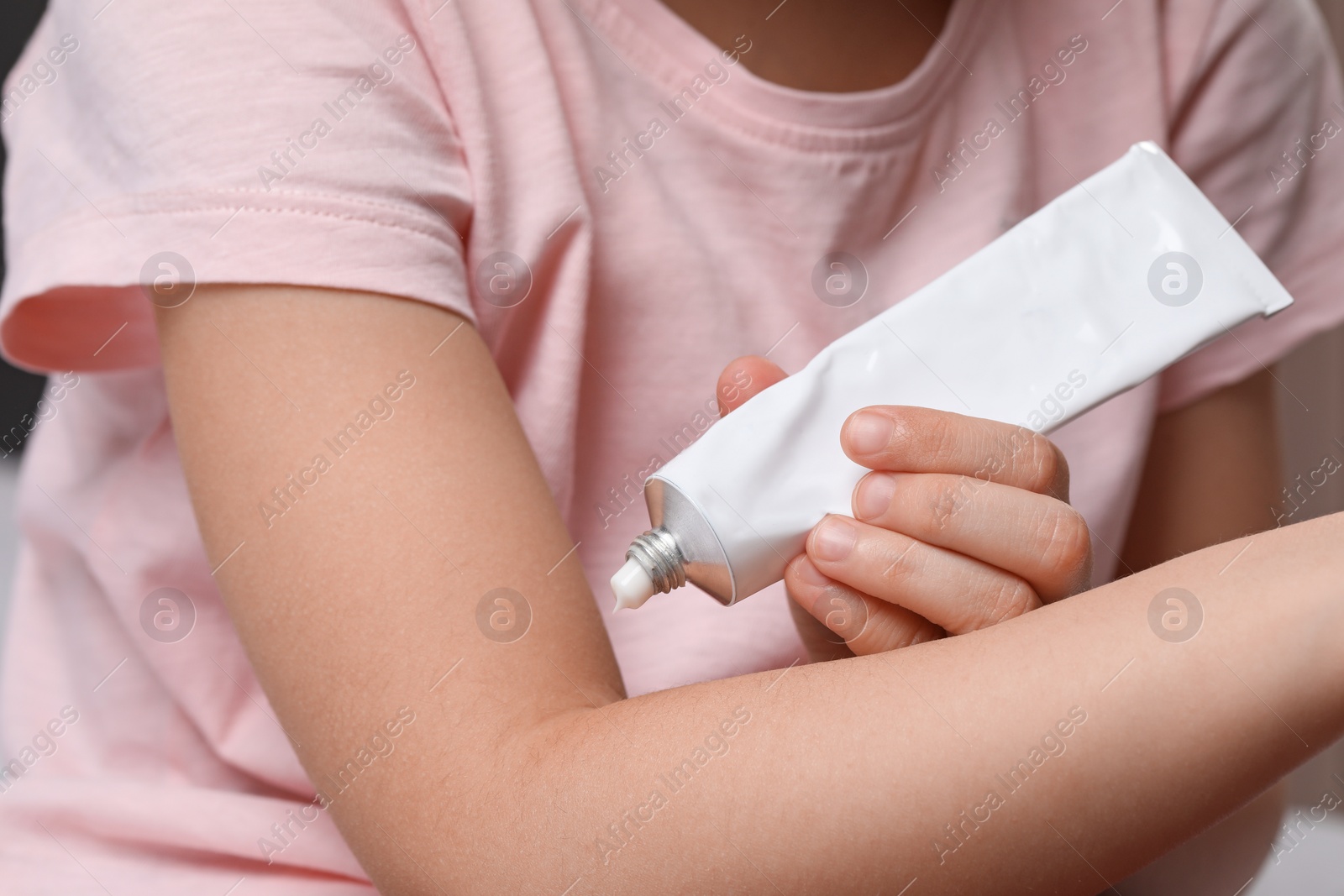 Photo of Little girl applying ointment onto her arm, closeup