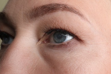 Photo of Closeup view of mature woman with eye cataract