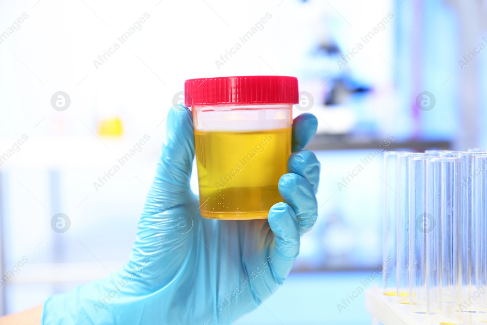 Photo of Laboratory assistant holding container with urine sample for analysis indoors, closeup