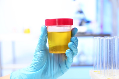 Photo of Laboratory assistant holding container with urine sample for analysis indoors, closeup