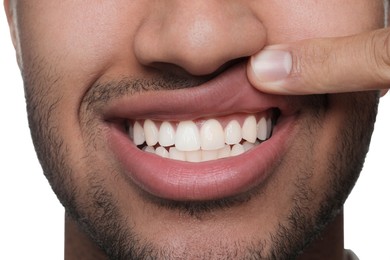 Man showing healthy gums on white background, closeup