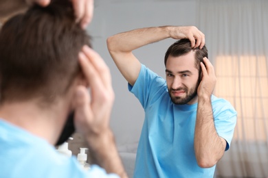 Photo of Young man with hair loss problem in front of mirror indoors