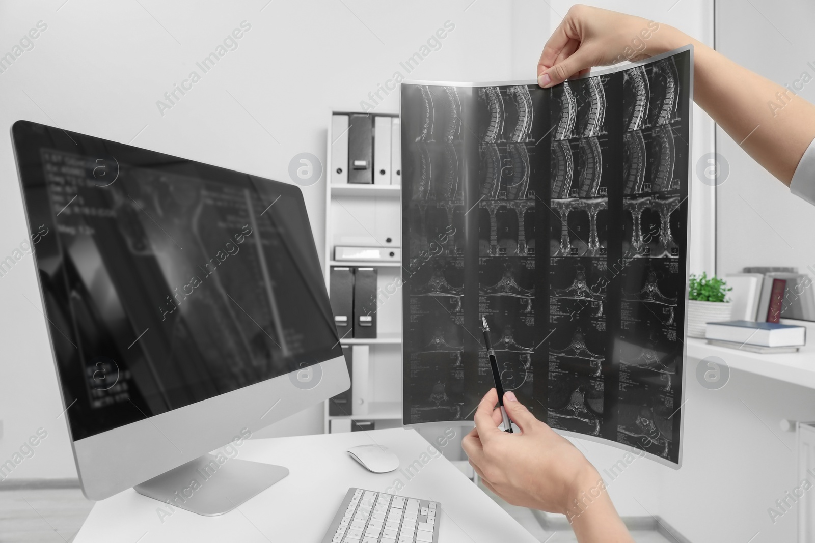 Photo of Doctor examining neck MRI image in clinic, closeup