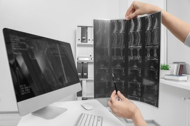 Photo of Doctor examining neck MRI image in clinic, closeup