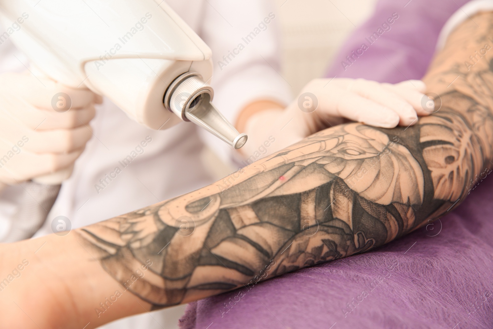 Photo of Young woman undergoing laser tattoo removal procedure in salon, closeup