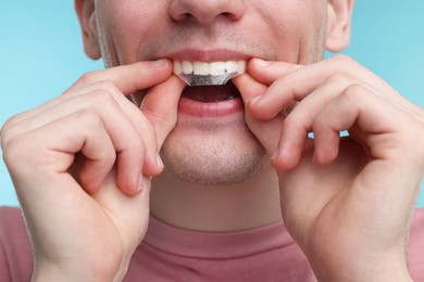 Photo of Young man applying whitening strip on his teeth against light blue background, closeup