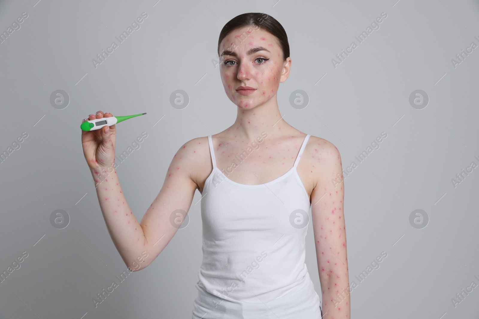 Photo of Woman with rash holding thermometer on light grey background. Monkeypox virus