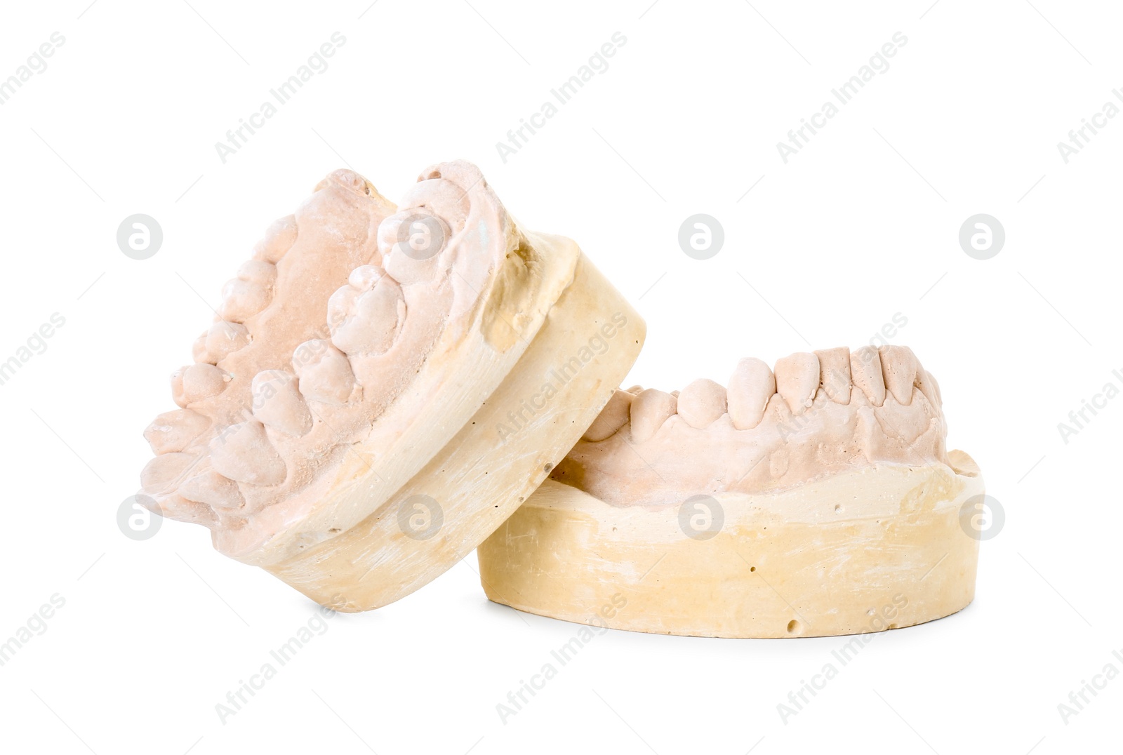 Photo of Dental model with jaws isolated on white. Cast of teeth