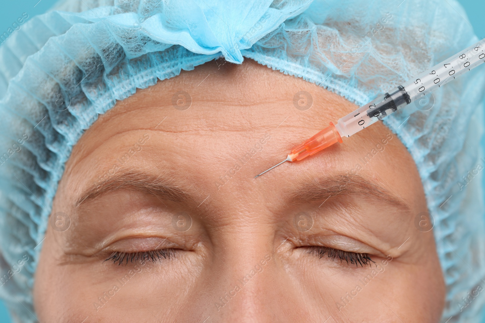 Photo of Senior woman getting facial injection, closeup. Cosmetic surgery