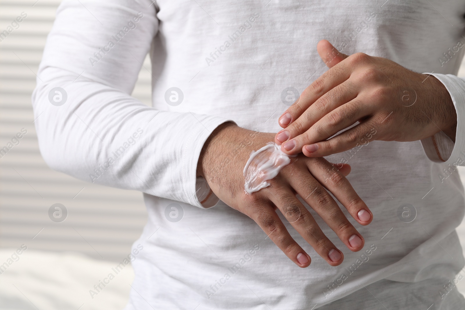 Photo of Man with dry skin applying cream onto his hand on light background, closeup