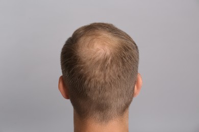 Photo of Man with hair loss problem on grey background, back view. Trichology treatment