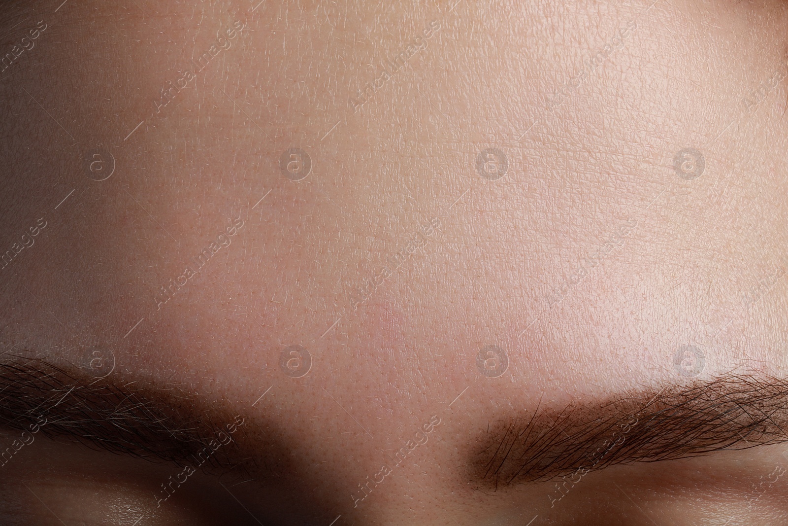 Photo of Closeup view of woman with normal skin