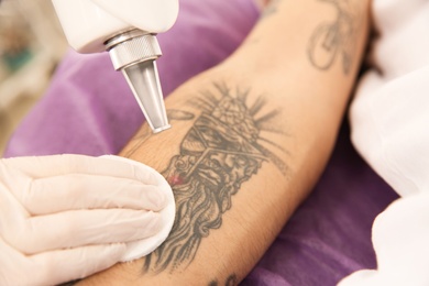 Young man undergoing laser tattoo removal procedure in salon, closeup