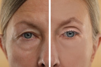 Aging skin changes. Woman showing face before and after rejuvenation, closeup. Collage comparing skin condition