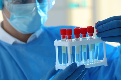 Photo of Scientist working with samples in laboratory, closeup. Medical research