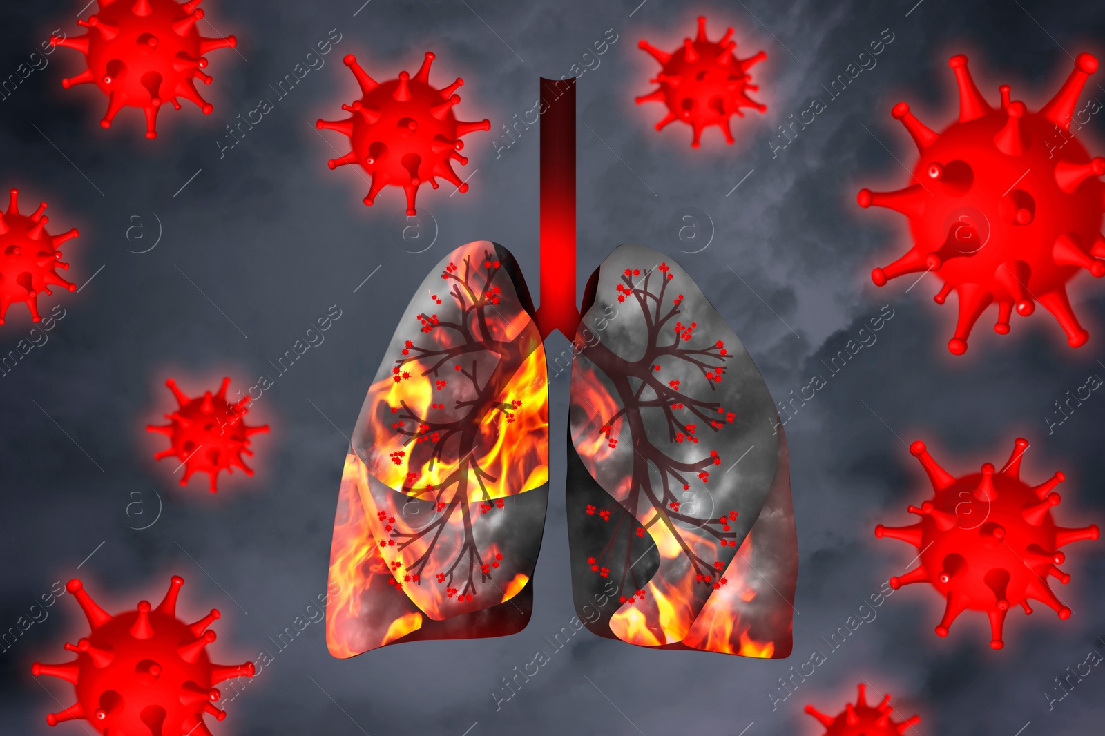 Illustration of  diseased human lungs surrounded by viruses on grey background