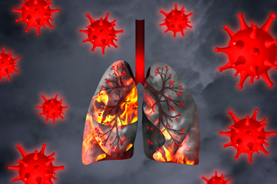 Illustration of  diseased human lungs surrounded by viruses on grey background