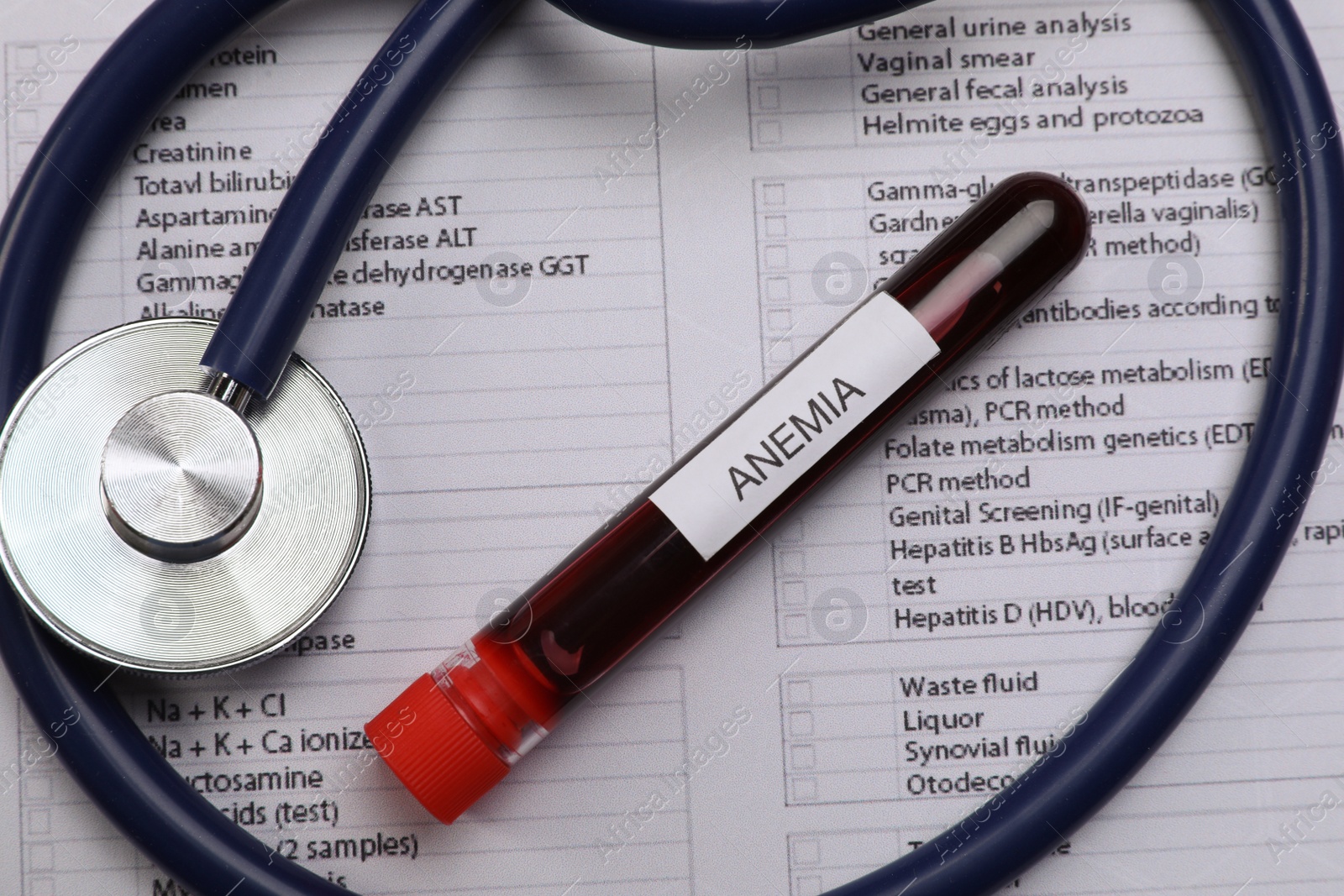 Photo of Test tube with blood sample and stethoscope on medical form, flat lay. Anemia concept