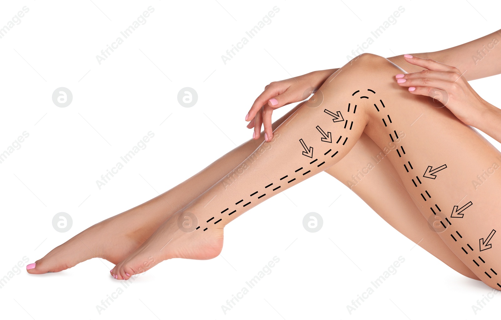 Image of Epilation guide - how to remove hair in proper direction. Woman with drawn lines and arrows on her beautiful smooth legs against white background