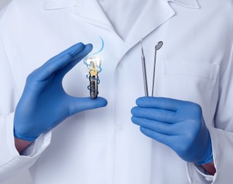 Image of Doctor with tools demonstrating virtual model of dental implant, closeup